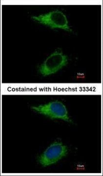 CARD6 Antibody in Immunocytochemistry (ICC/IF)