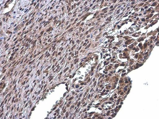 RSK2 Antibody in Immunohistochemistry (Paraffin) (IHC (P))