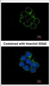 MEK2 Antibody in Immunocytochemistry (ICC/IF)
