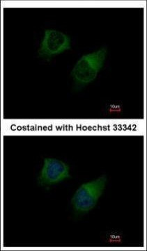 DGKG Antibody in Immunocytochemistry (ICC/IF)