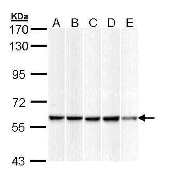 DNAJC3 Antibody in Western Blot (WB)