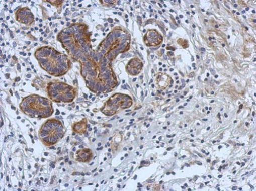 CERK Antibody in Immunohistochemistry (Paraffin) (IHC (P))