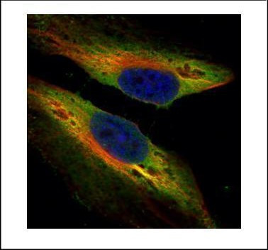 PTK9 Antibody in Immunocytochemistry (ICC/IF)