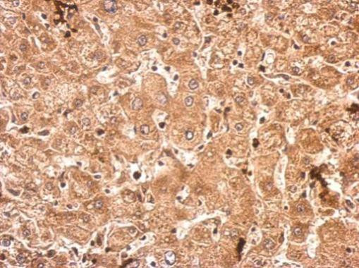 SRPK3 Antibody in Immunohistochemistry (Paraffin) (IHC (P))