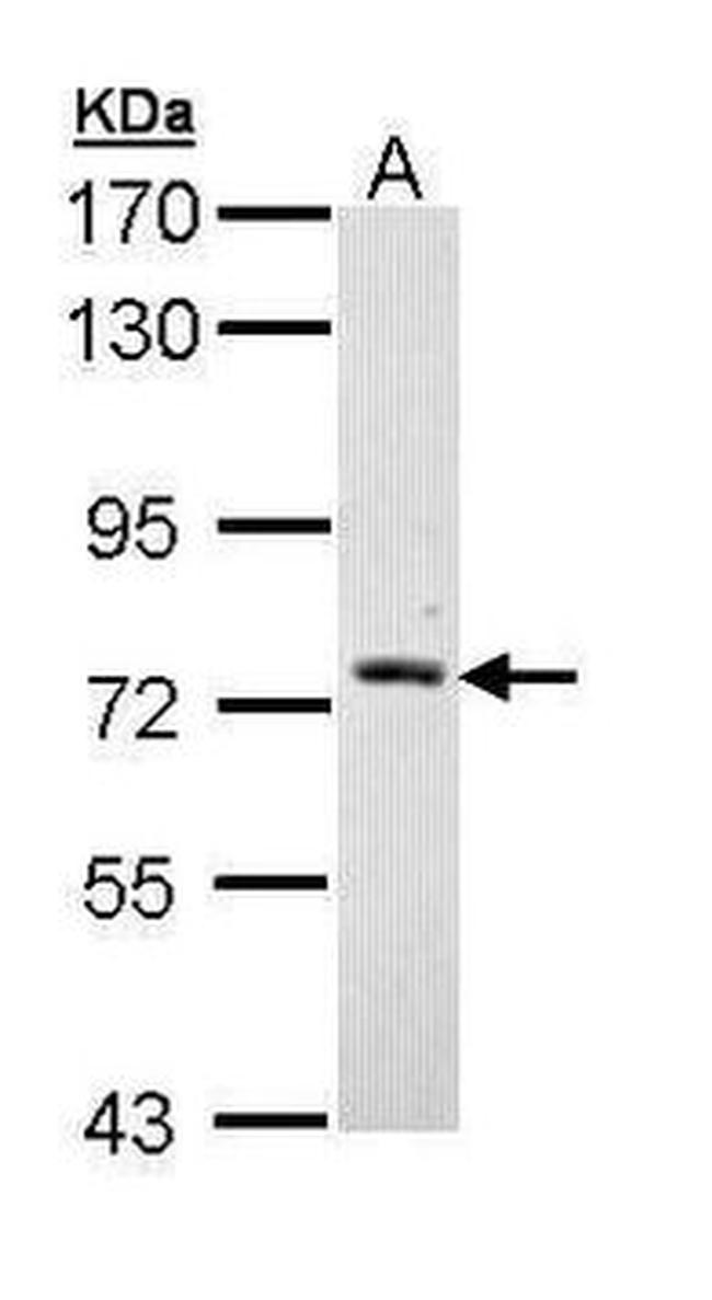 GRK6 Antibody in Western Blot (WB)