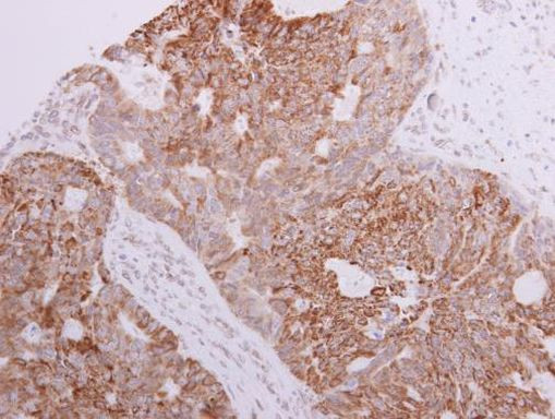 FASTKD3 Antibody in Immunohistochemistry (Paraffin) (IHC (P))