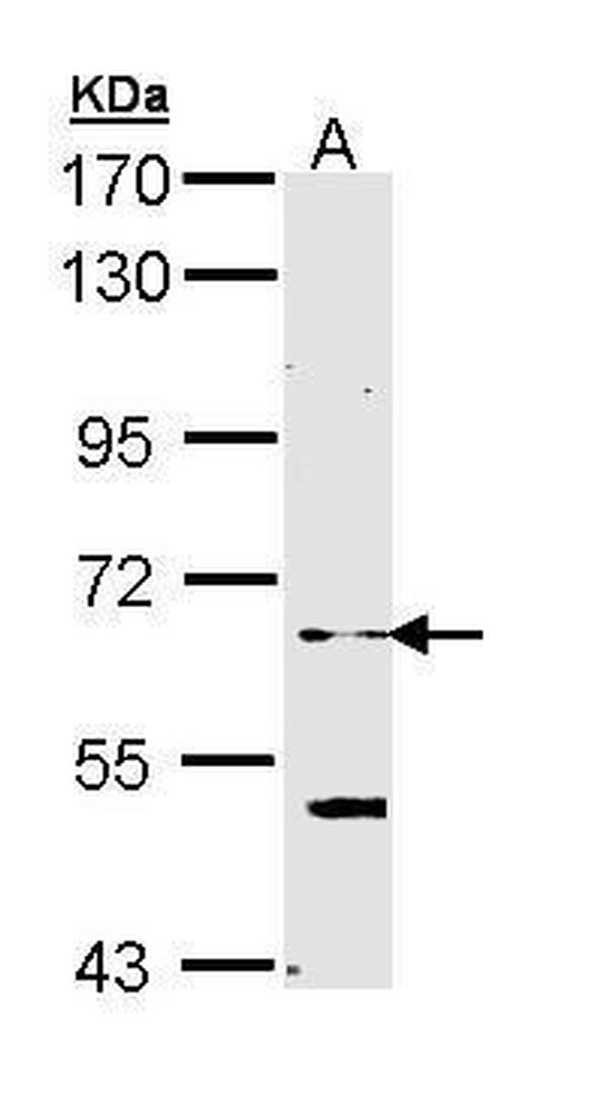 ELP3 Antibody in Western Blot (WB)