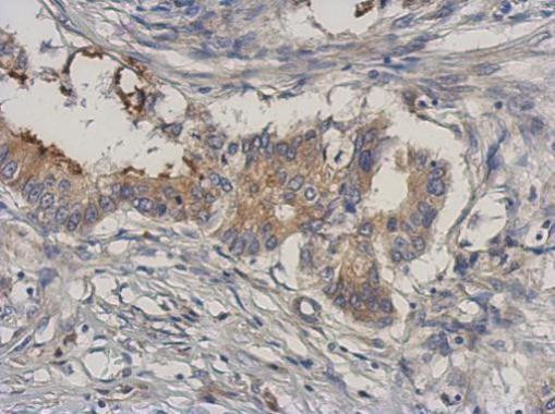 MEKK3 Antibody in Immunohistochemistry (Paraffin) (IHC (P))