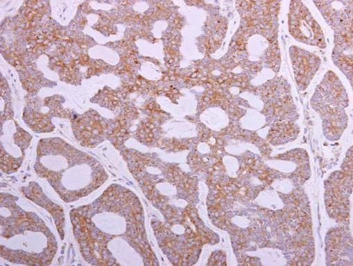TRIP6 Antibody in Immunohistochemistry (Paraffin) (IHC (P))