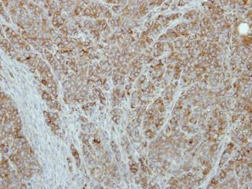 CaMKII beta Antibody in Immunohistochemistry (Paraffin) (IHC (P))