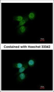 Lyn Antibody in Immunocytochemistry (ICC/IF)