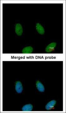 FAF1 Antibody in Immunocytochemistry (ICC/IF)