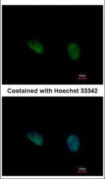 PHKG2 Antibody in Immunocytochemistry (ICC/IF)