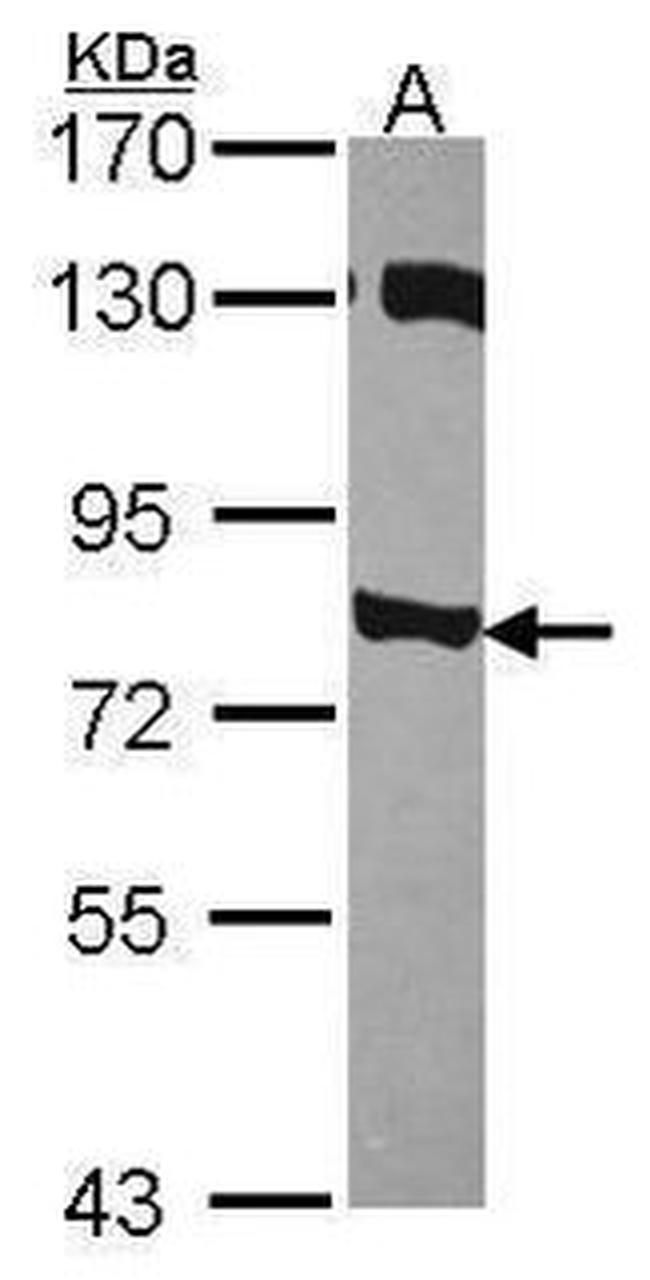 PIK3R2 Antibody in Western Blot (WB)