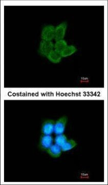 PFKM Antibody in Immunocytochemistry (ICC/IF)
