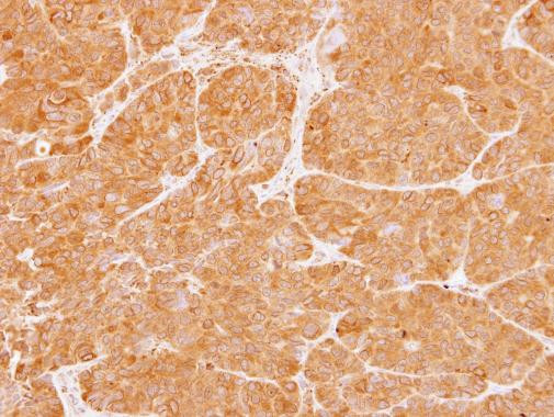 PKC zeta Antibody in Immunohistochemistry (Paraffin) (IHC (P))