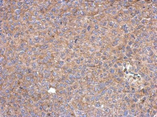PPIP5K2 Antibody in Immunohistochemistry (Paraffin) (IHC (P))