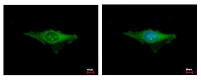 IDE Antibody in Immunocytochemistry (ICC/IF)