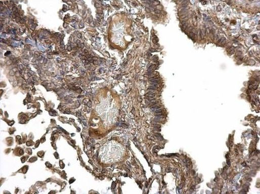 IGF1R Antibody in Immunohistochemistry (Paraffin) (IHC (P))