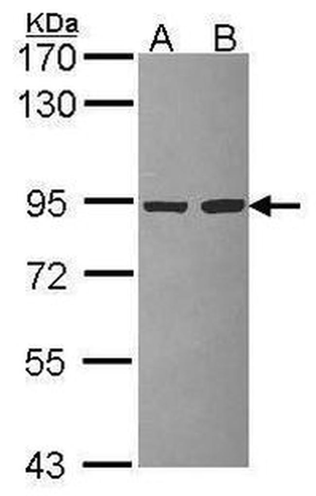 PIK3R2 Antibody in Western Blot (WB)