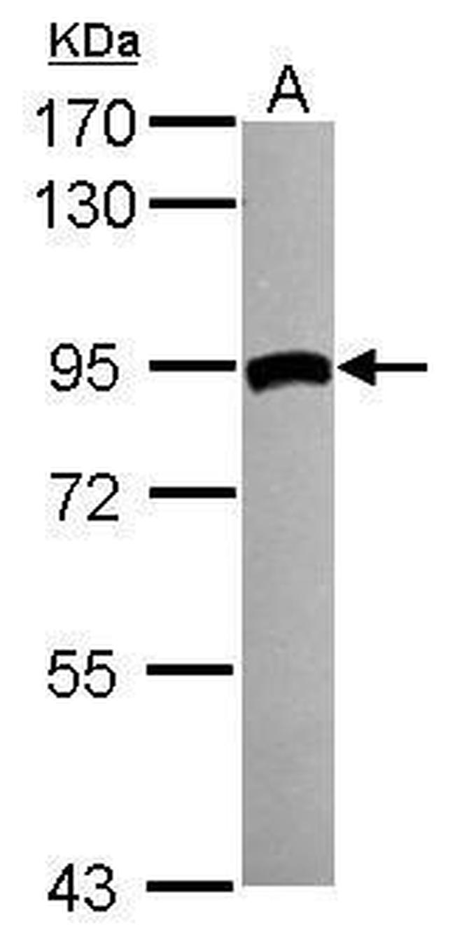 TGM2 Antibody in Western Blot (WB)
