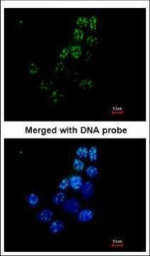 XRCC1 Antibody in Immunocytochemistry (ICC/IF)