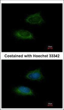 Adenylate Kinase 2 Antibody in Immunocytochemistry (ICC/IF)