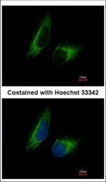 PFKFB1 Antibody in Immunocytochemistry (ICC/IF)