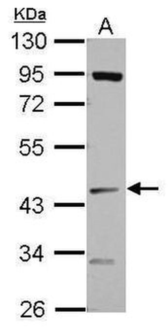 NME7 Antibody in Western Blot (WB)