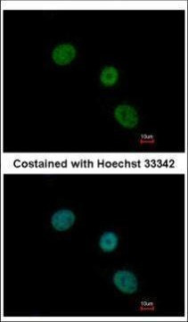ELP4 Antibody in Immunocytochemistry (ICC/IF)