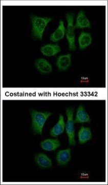 GALK2 Antibody in Immunocytochemistry (ICC/IF)
