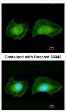 SGK3 Antibody in Immunocytochemistry (ICC/IF)