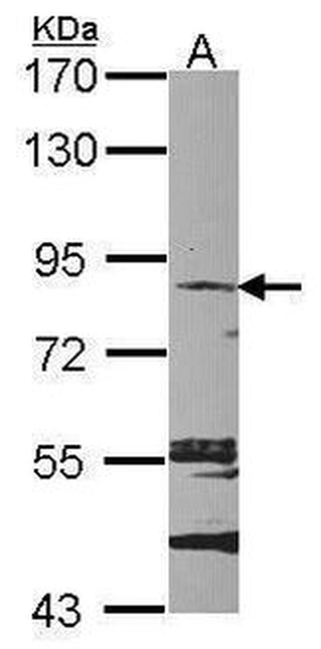 MARK2 Antibody in Western Blot (WB)