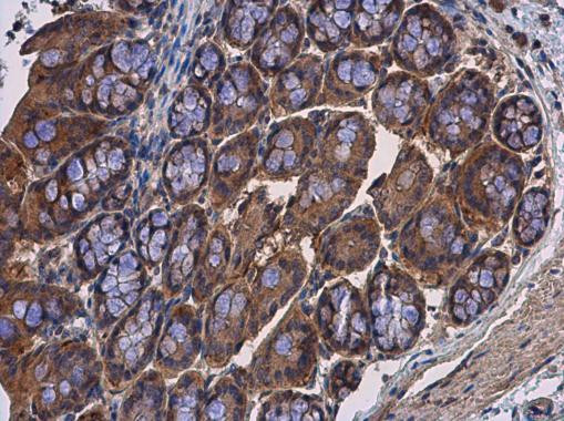 Calpain 2 Antibody in Immunohistochemistry (Paraffin) (IHC (P))