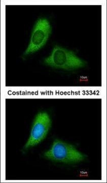 BNIP3L Antibody in Immunocytochemistry (ICC/IF)