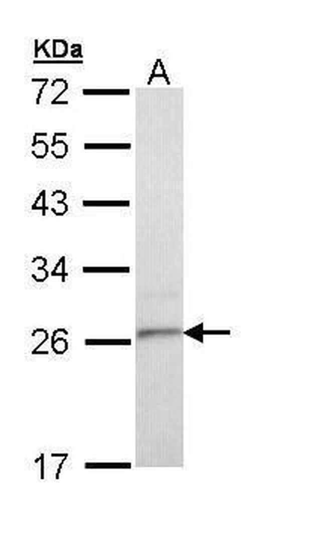 TSPAN6 Antibody in Western Blot (WB)