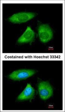 ARC Antibody in Immunocytochemistry (ICC/IF)