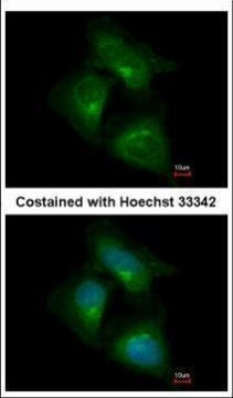 CDK5RAP1 Antibody in Immunocytochemistry (ICC/IF)