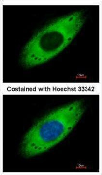 RPS3A Antibody in Immunocytochemistry (ICC/IF)