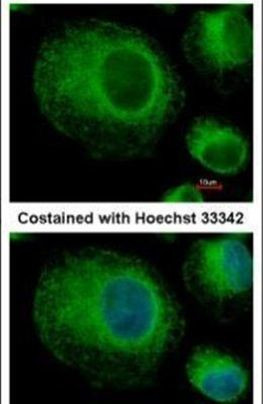 BAP31 Antibody in Immunocytochemistry (ICC/IF)