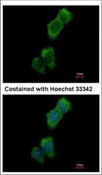 LOK Antibody in Immunocytochemistry (ICC/IF)