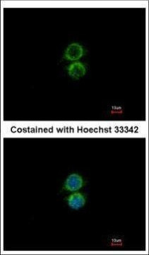 PIP5K1A Antibody in Immunocytochemistry (ICC/IF)
