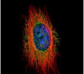 MELK Antibody in Immunocytochemistry (ICC/IF)