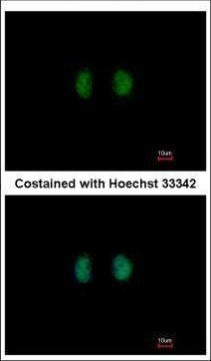 IPPK Antibody in Immunocytochemistry (ICC/IF)