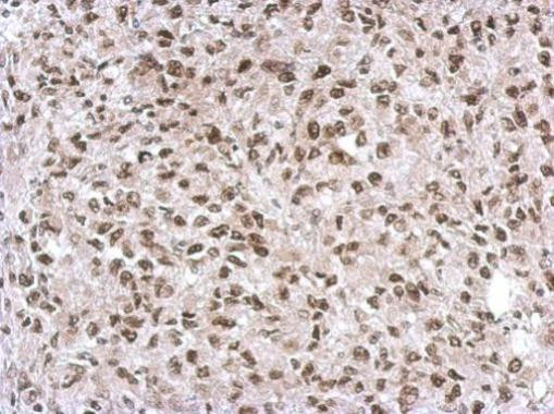 SNIP1 Antibody in Immunohistochemistry (Paraffin) (IHC (P))
