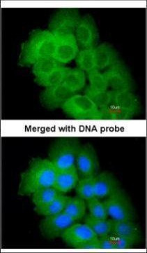 STK32C Antibody in Immunocytochemistry (ICC/IF)