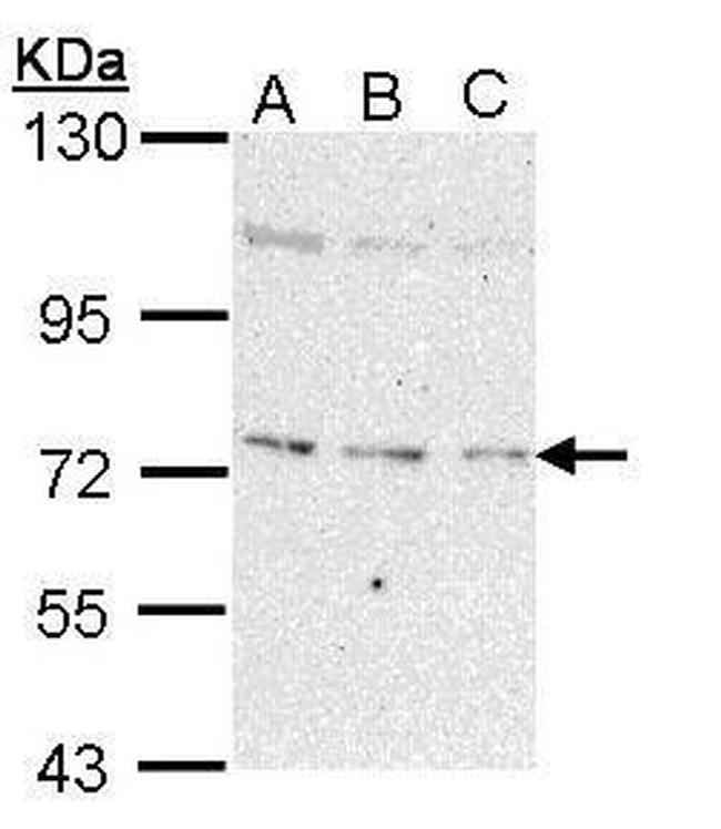 NEK8 Antibody in Western Blot (WB)