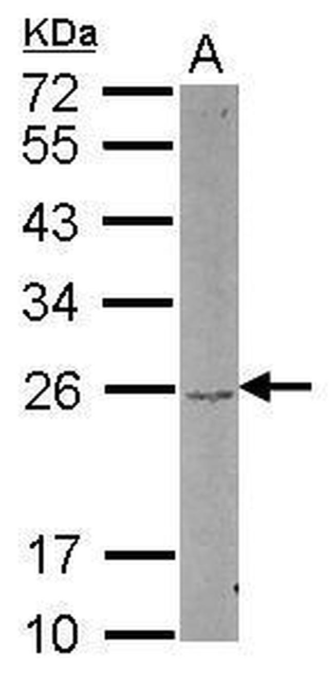DUSP22 Antibody in Western Blot (WB)
