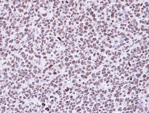 p53DINP1 Antibody in Immunohistochemistry (Paraffin) (IHC (P))