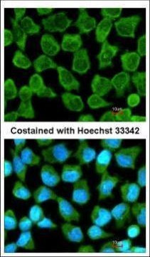 KappaB ras2 Antibody in Immunocytochemistry (ICC/IF)